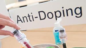 Lee más sobre el artículo Resultados Doping Cintra